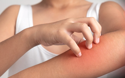 A patient with chronic itch scratches arm.