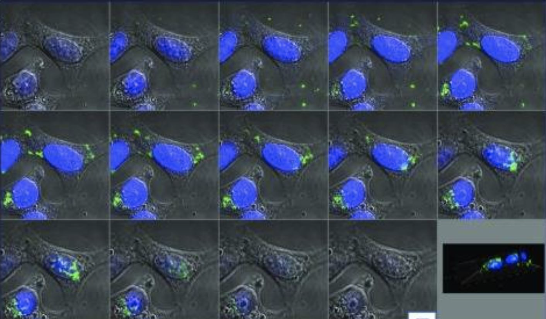 The bacterial protein DnaK (green) is taken up into human cancer cells and moves to the cell’s nucleus (blue), where the DNA is located. Source: PNAS 2018 Dec 18; 115(51): E12005–E12014.