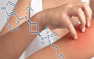 chemical diagram overlays patient scratching arm