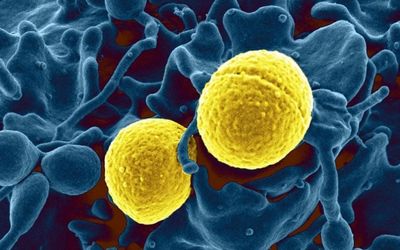 The USA300 strain of Staphylococcus aureus bacteria, colorized in gold, shown outside a white blood cell.RML/NIAID.